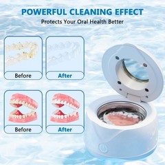 Ultrasonic Retainer Cleaner Machine 45kHz 200ml Portable Ultra Sonic Retainer…