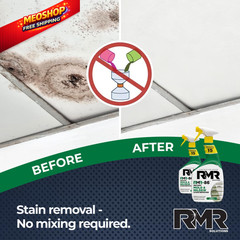 RMR-86 Instant Mold and Mildew Stain Remover Spray – 32 Fl Oz (Pack of 2)