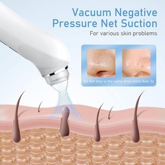 Blackhead Remover Vacuum, USB Interface Type 1 Count (Pack of 1), Light Pink