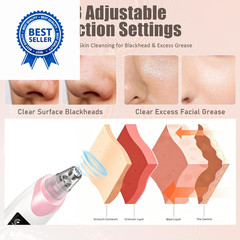 2026 Blackhead Remover Pore Vacuum,Facial 1 Count (Pack of 1), Pink