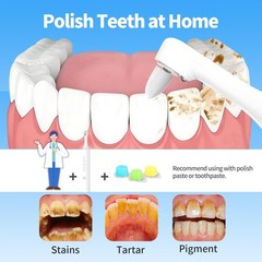 Tooth Polisher, Rechargeable Teeth Whitening Kit with 5 Speed Modes, White