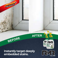 RMR-86 Instant Mold and Mildew Stain Remover Spray – 32 Fl Oz (Pack of 2)