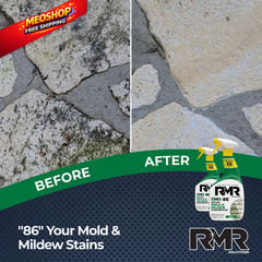 RMR-86 Instant Mold and Mildew Stain Remover Spray – 32 Fl Oz (Pack of 2)
